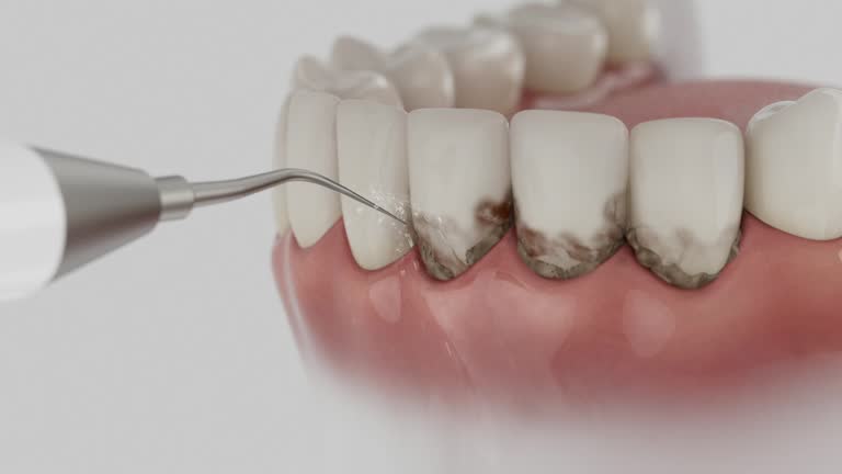 Reliable Dental Implants contractor in Romulus, MI by Smile Center Dentistry